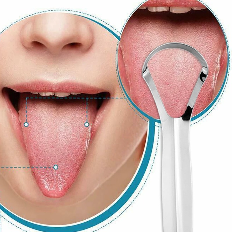 Tongue Scraper Metal - 깨끗한 혀 스크레이퍼 혀 리무버 구취