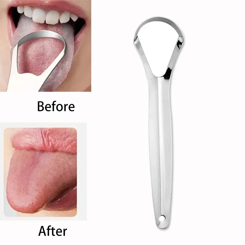 Tongue Scraper Metal - 구취증 치석 제거기 스테인리스 스틸 세척