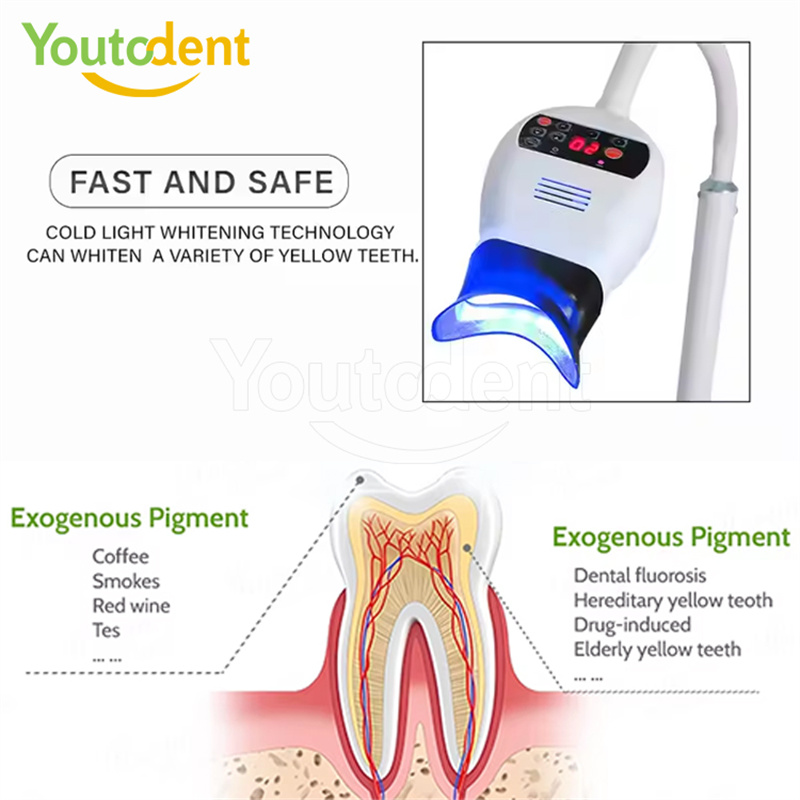 전문 치과용 3색 광 램프 치아 미백기 미백 촉진 장치 - Teeth Whitening Led 리뷰 및 가격
