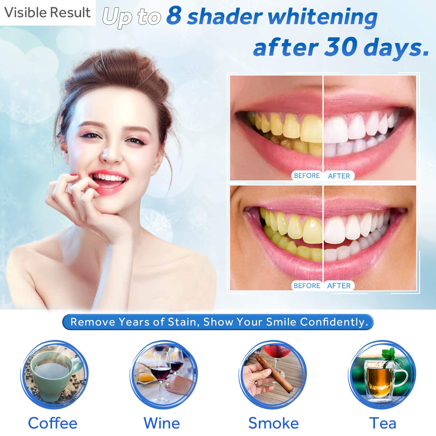 치아 미백 젤 리필 주사기 치아 미백 젤 인비스알라인  - Teeth Whitening Doctor 리뷰 및 가격