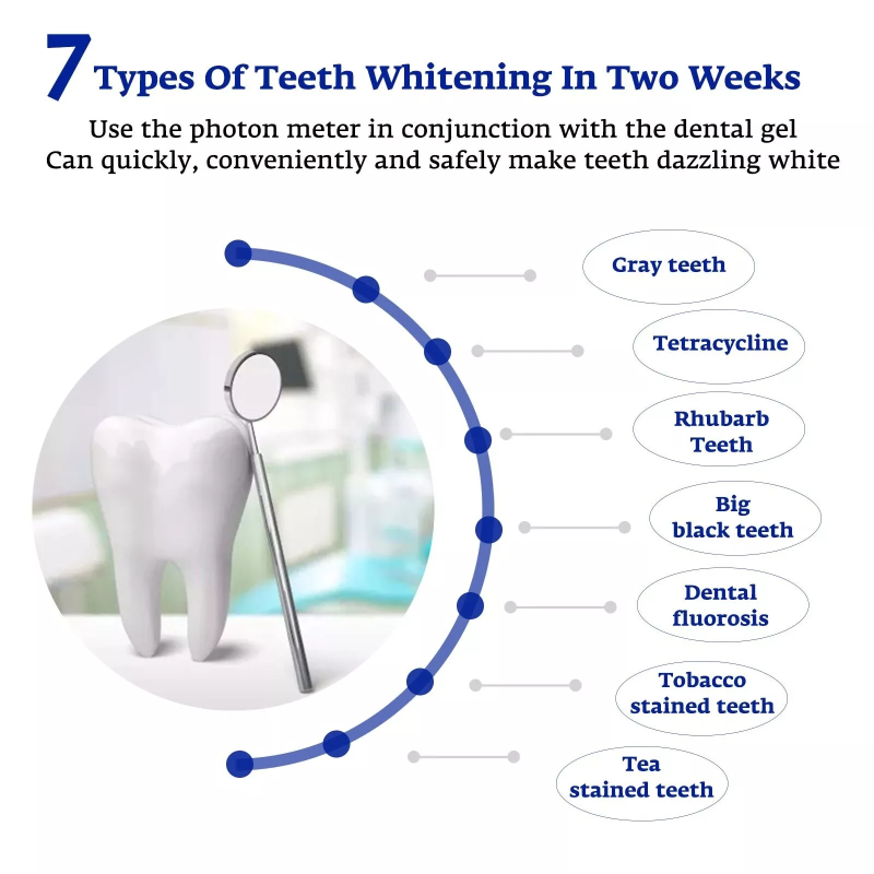 치아 미백 가속기 스마트 LED 블루 라이트 휴대용 U - Teeth Whitening Doctor 리뷰 및 가격