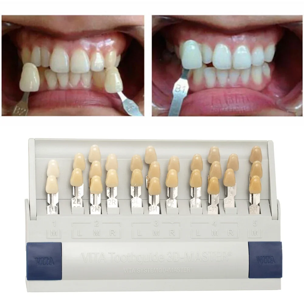Vita 3D 마스터 치과 실험실 표백제 쉐이드 가이드 - Teeth Whitening Shade Guide 리뷰 및 가격